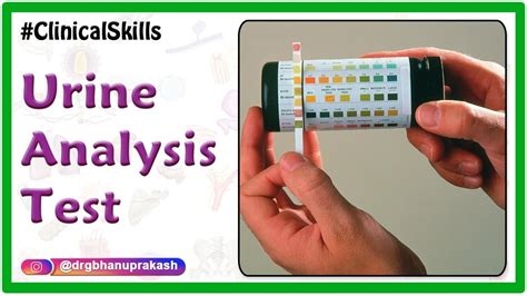 Urine Analysis Test Procedure Biochemistry Practicals Youtube