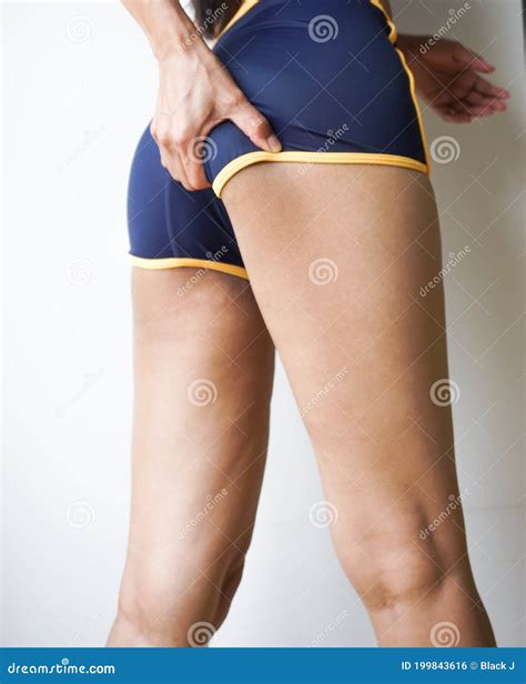 Women Holding Buttocks With Cellulite Skin Problem Body Care Stock