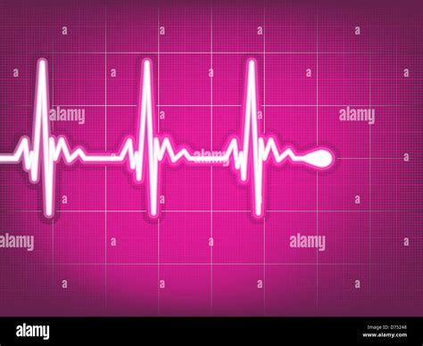 Single Trace Ekg Hi Res Stock Photography And Images Alamy