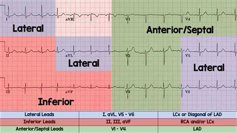 Medicine Ta On Twitter 🫀ecg And Coronary Anatomy Source Srrezaie