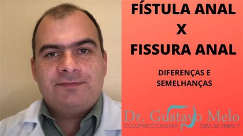 FÍstula X Fissura Quais São As Diferenças E Semelhanças Entre A