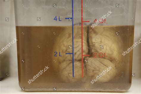 Human Brain Used Dissection Seen Gross Editorial Stock Photo - Stock ...