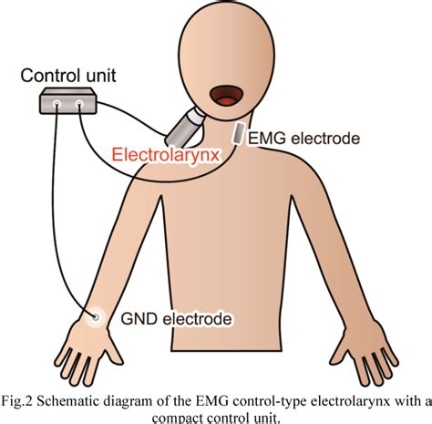 Figure 3 From Controllable Artificial Larynx Using Neck Myoelectric Signal Semantic Scholar