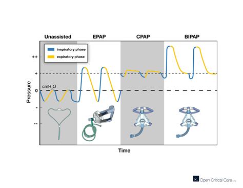 Waveforms For Cpap Bipap And Epap Open Critical Care