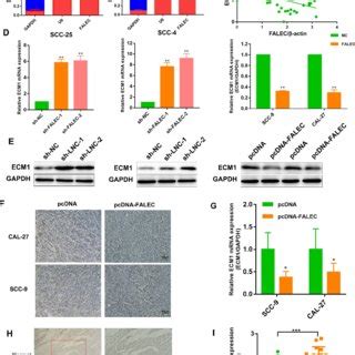 ECM1 Is Highly Expressed In TSCC And Negatively Controlled By FALEC