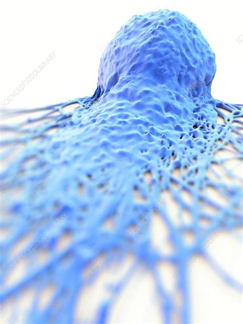 Cancer cell, illustration - Stock Image - C029/8973 - Science Photo Library