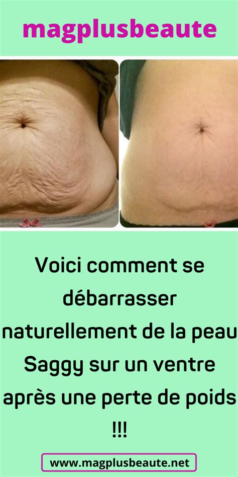 Voici comment se débarrasser naturellement de la peau Saggy sur un