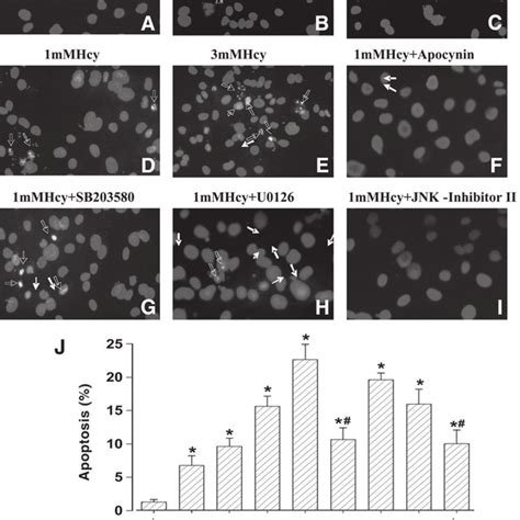 A Effect Of Homocysteine Hcy M M M On Caspase Activity