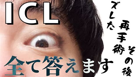 Icl（眼内レンズによる近視矯正手術）でレンズがズレて再手術した人が動画に届いた質問に答えてみた【レーシック？いいえiclです】 Icl