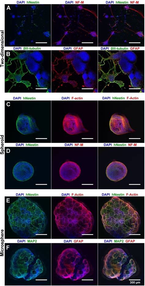 Microsphere Culture Allows Nsc Differentiation To Neuronal And Glial