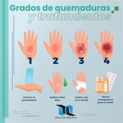 Quemaduras Su Clasificación Y Tratamiento