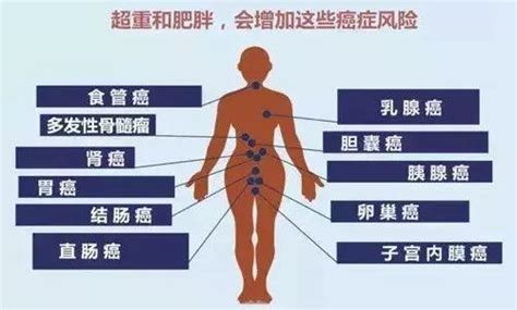 權威機構公佈13種癌症都與肥胖有關，你還敢胖嗎？ 每日頭條