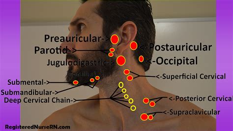 Swollen Cervical And Supraclavicular Lymph Nodes Hiloandco