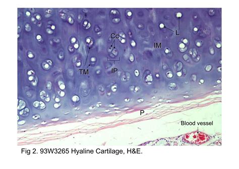 Block6 1fig 2 93w3265 Hyaline Cartilage Hande