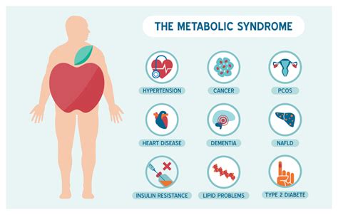 A Mediterranean Style Diet May Be The Best Metabolic Syndrome Diet University Health News