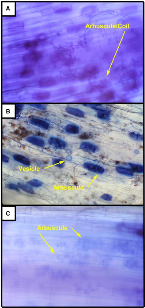 Root Sections Stained With Trypan Blue Showing Arbuscular Mycorrhizal