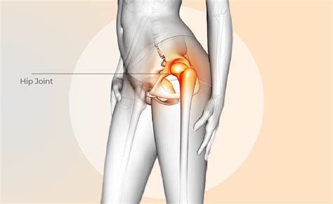 Hip PAIN HIP Joint Injuries And Physiotherapy Curezone Physiotherapy