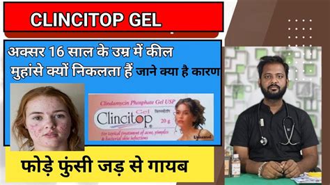 Clincitop Gel Review Price Side Effects How To Use Clincitop