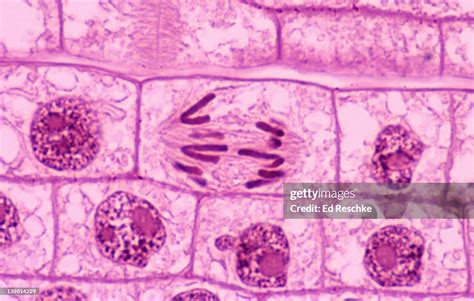 Plant Mitosis Anaphase Onion Are Visible High Res Stock Photo Getty