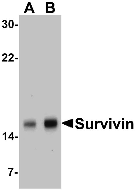 Anti Survivin Nt Antibody Qed Bioscience Inc