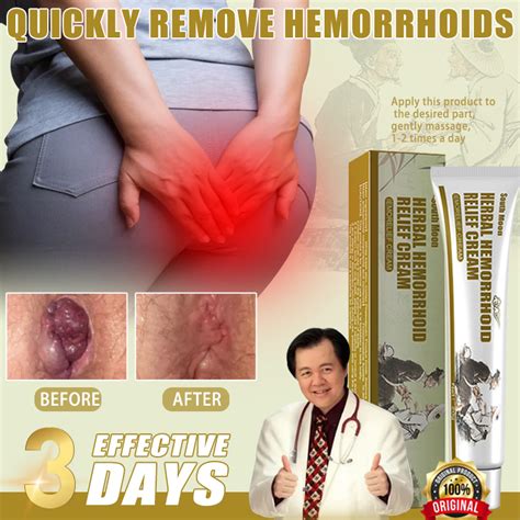 Hemorrhoids Miracle Ointment Hemorrhoids Cream Original Gamot Sa