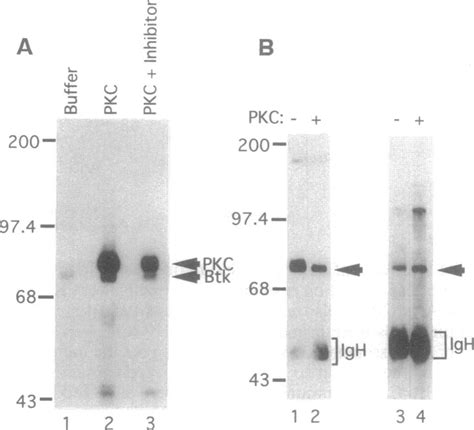 Pkc Phosphorylates Btk In Vitro A Partially Purified Btk Ng