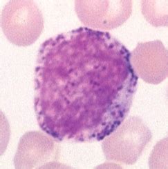 Wbc Morphology And Abnormalities Flashcards Quizlet