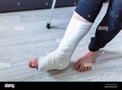 Roken leg fotografías e imágenes de alta resolución Alamy