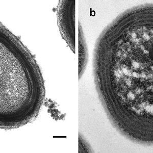 1 Transmission Electron Micrographs Of Negatively Stained Thin