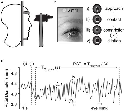 Hippus Pupil Reaction