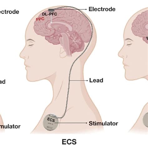 Schematic Representation Of Invasive Brain Stimulation Techniques Dbs Download Scientific