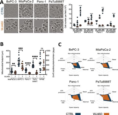 Myoferlin Targeting Triggers Mitophagy And Primes Ferroptosis In