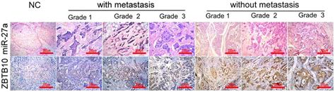 In Situ Hybridization For Mir 27a And Immunohistochemical Staining For