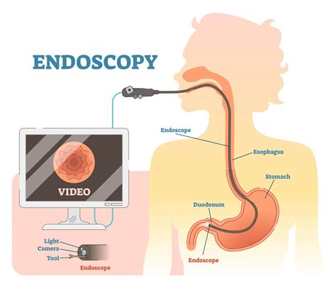 Endoscopy Services | Dr Ong Paediatrician & Gastroenterologist