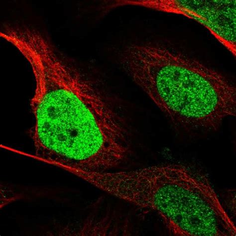 Rabbit Polyclonal Anti Cebpb Antibody Buy For Research Highly