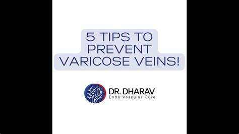 Preventing Varicose Veins Varicose Vein Treatment In Kochi Varicose