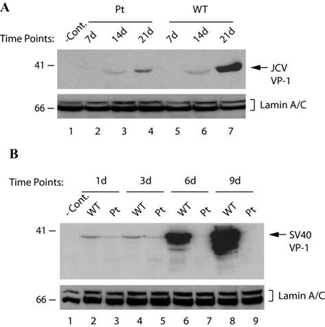 Analysis Of Late Capsid Protein Vp1 Expression In Phfg Cells