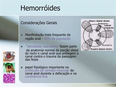 Ppt Patologia Perianal Powerpoint Presentation Free Download Id 829116