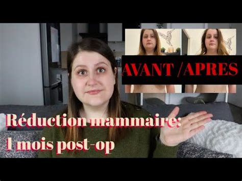 Réduction mammaire prix cicatrices résultat 1 mois post op YouTube