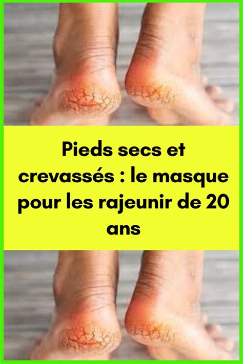 Pieds secs et crevassés le masque pour les rajeunir de 20 ans Soin