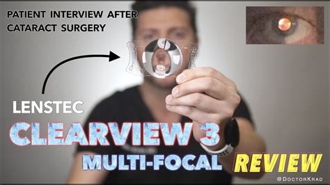 Lenstec Clearview Multifocal Iol Review Cataract Surgery Real