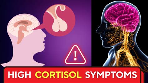 Top 8 Symptoms Of High Cortisol Youtube