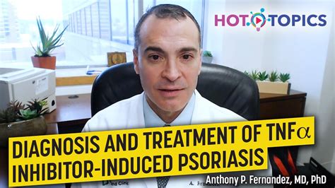 Diagnosis And Treatment Of Tnf Inhibitor Induced Psoriasis Youtube