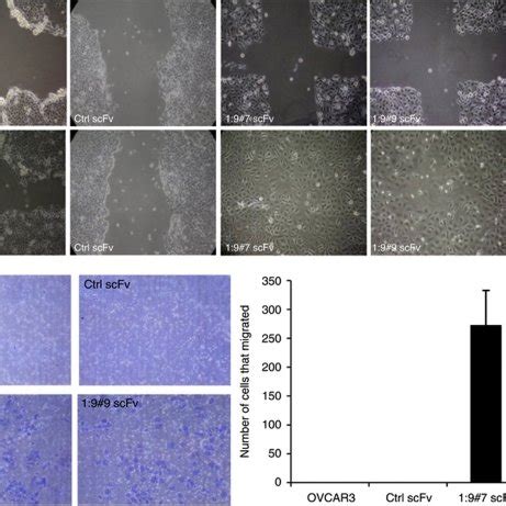 CA125 MUC16 Knockdown Enhances Cell Motility A Wound Healing Assay