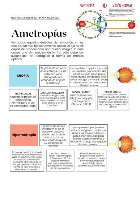 Ametropías Y Patología Ocular Gaby Rh Udocz