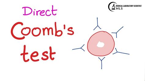 Direct Coombs Test Dat Principle Procedure Interpretations And