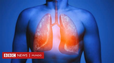 La Extraordinaria Habilidad De Los Pulmones Para Reparar El Daño