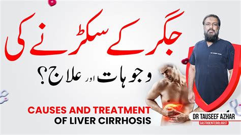 Liver Cirrhosis Causes Treatment In Urdu Jigar Ke Sukarna Ki