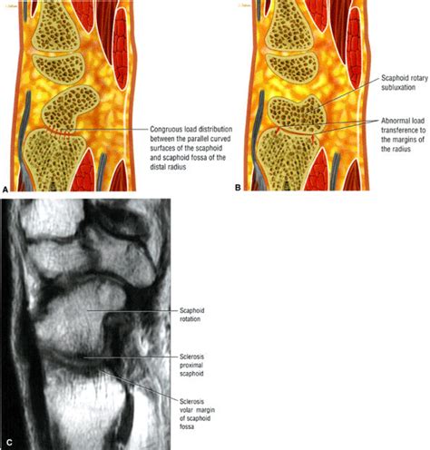 The Wrist And Hand Teachme Orthopedics