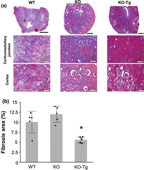 Assessment Of Renal Fibrosis Evaluated By Azan Staining A Download Scientific Diagram